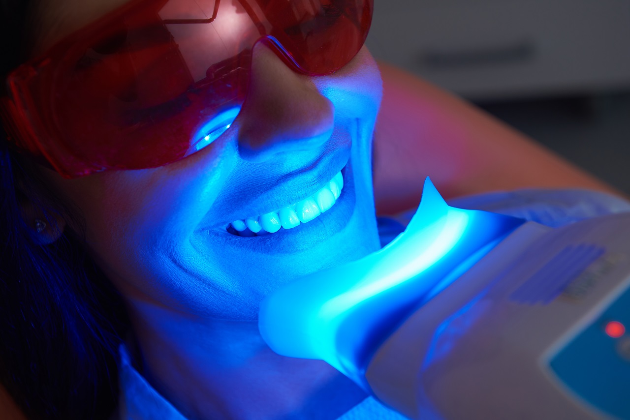 Jakie są metody wybielania zębów?